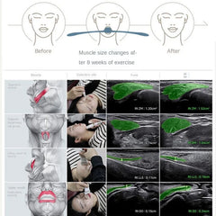 Jaw Exerciser Bite Muscle Training Face-lift V Face Thin Face Artifact Nasolabial Wrinkle Remover Double Chin Reducer Face Lift